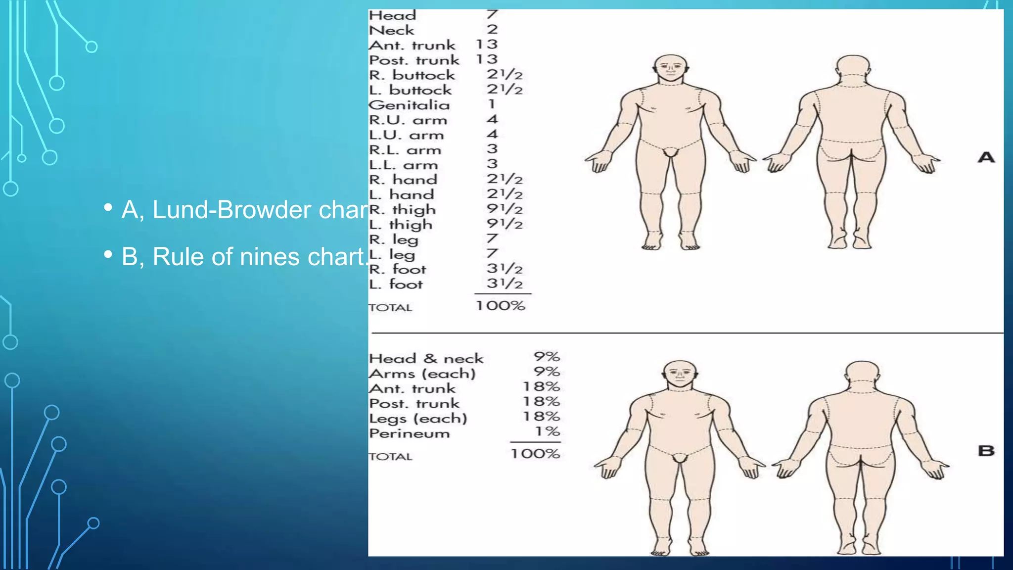 • A, Lund-Browder chart.
• B, Rule of nines chart.
 