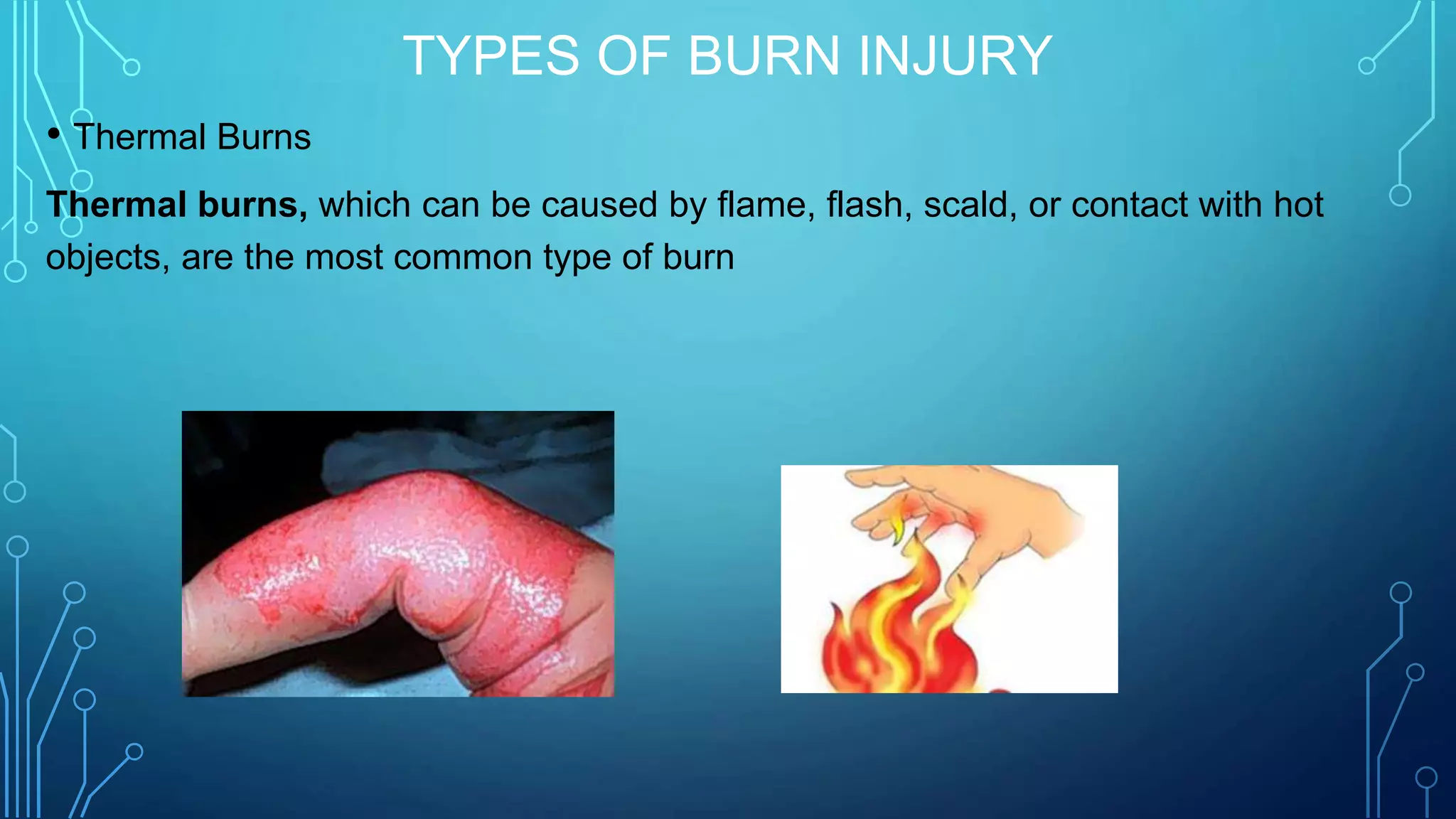 TYPES OF BURN INJURY
• Thermal Burns
Thermal burns, which can be caused by flame, flash, scald, or contact with hot
objects, are the most common type of burn
 