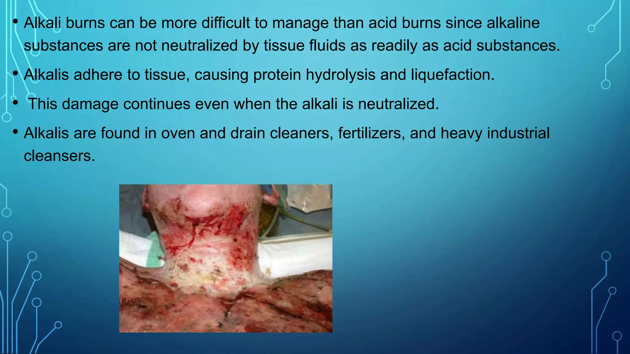 • Alkali burns can be more difficult to manage than acid burns since alkaline
substances are not neutralized by tissue fluids as readily as acid substances.
• Alkalis adhere to tissue, causing protein hydrolysis and liquefaction.
• This damage continues even when the alkali is neutralized.
• Alkalis are found in oven and drain cleaners, fertilizers, and heavy industrial
cleansers.
 