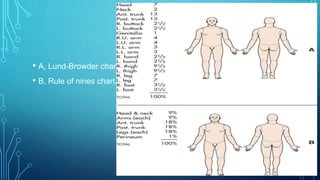 • A, Lund-Browder chart.
• B, Rule of nines chart.
 