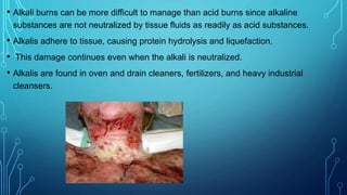 • Alkali burns can be more difficult to manage than acid burns since alkaline
substances are not neutralized by tissue fluids as readily as acid substances.
• Alkalis adhere to tissue, causing protein hydrolysis and liquefaction.
• This damage continues even when the alkali is neutralized.
• Alkalis are found in oven and drain cleaners, fertilizers, and heavy industrial
cleansers.
 