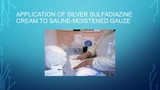 APPLICATION OF SILVER SULFADIAZINE
CREAM TO SALINE-MOISTENED GAUZE
 