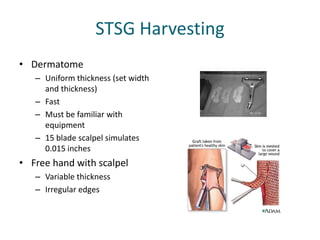 STSG Harvesting
• Dermatome
– Uniform thickness (set width
and thickness)
– Fast
– Must be familiar with
equipment
– 15 blade scalpel simulates
0.015 inches
• Free hand with scalpel
– Variable thickness
– Irregular edges
 