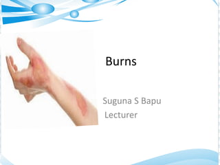 Burns
Suguna S Bapu
Lecturer
 
