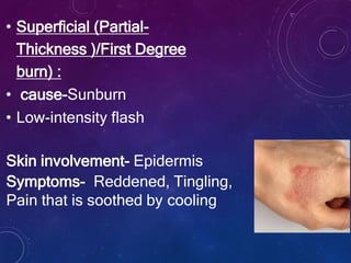 • Superficial (Partial-
Thickness )/First Degree
burn) :
• cause-Sunburn
• Low-intensity flash
Skin involvement- Epidermis
Symptoms- Reddened, Tingling,
Pain that is soothed by cooling
 