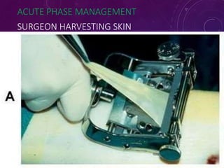 ACUTE PHASE MANAGEMENT
SURGEON HARVESTING SKIN
7
1
 