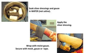 Soak silver dressings and gauze
in WATER (not saline).
Apply the
silver dressing.
Wrap with moist gauze.
Secure with mesh, gauze or tape.
 