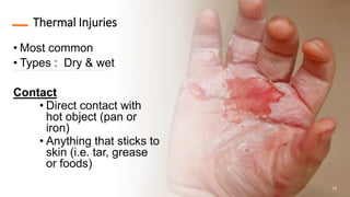 Thermal Injuries
• Most common
• Types : Dry & wet
Contact
• Direct contact with
hot object (pan or
iron)
• Anything that sticks to
skin (i.e. tar, grease
or foods)
13
 