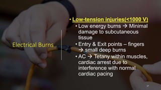 Electrical Burns
• Low-tension injuries(<1000 V)
• Low energy burns  Minimal
damage to subcutaneous
tissue
• Entry & Exit points – fingers
 small deep burns
• AC  Tetany within muscles,
cardiac arrest due to
interference with normal
cardiac pacing
17
 