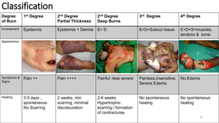 29
Classification
Degree
of Burn
1st Degree 2nd Degree
Partial Thickness
2nd Degree
Deep Burns
3rd Degree 4th Degree
Involvement Epidermis Epidermis + Dermis E+ D E+D+Subcut tissue E+D+S+muscles,
tendons & bone
Appearance
Symptoms &
Signs
Pain ++ Pain ++++ Painful -less severe Painless,insensitive,
Severe Edema
No Edema
Healing 3-5 days ,
spontaneous
No Scarring
2 weeks, min
scarring, minimal
discolouration
2-6 weeks
Hypertrophic
scarring / formation
of contractures
No spontaneous
healing
No spontaneous
healing
 
