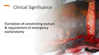 Clinical Significance
Formation of constricting eschars
& requirement of emergency
escharotomy
36
 