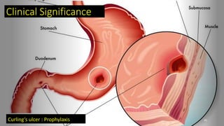 Clinical Significance
Curling’s ulcer : Prophylaxis 45
 