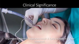 Clinical Significance
Important to identify respiratory insult & Early Intubation in case
required. 56
 