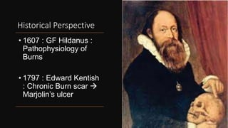 Historical Perspective
• 1607 : GF Hildanus :
Pathophysiology of
Burns
• 1797 : Edward Kentish
: Chronic Burn scar 
Marjolin’s ulcer
6
 
