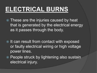 Burns its types, causes and management. | PPTX