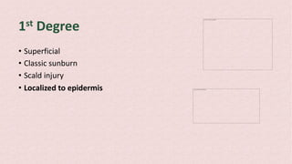 1st Degree
• Superficial
• Classic sunburn
• Scald injury
• Localized to epidermis
The picture can't be displayed.
The picture can't be displayed.
 