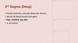 2nd Degree (Deep)
• Partial-thickness, extends deep into dermis.
• Nerves & blood vessels damaged.
• Pale, mottled, dry skin.
• ↓ sensation
The picture can't be displayed.
The picture can't be displayed.
The picture can't be displayed.
 