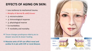 EFFECTS OF AGING ON SKIN:
• Less resilience to mechanical trauma.
• Atrophy of dermal & subQ tissues
• ↓ microcirculation
• ↓ immunological response
• ↓ physiological reserve
• Co-morbidities
• ↑ morbidity and mortality
v Tissue changes predispose elderly pts to
deeper wounds & slower healing.
v Massive amts of IVF can effect renal and
cardiac fx in pts with CHF or renal disease.
 