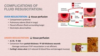 COMPLICATIONS OF
FLUID RESUSCITATION:
OVER-RESUSCITATION: ↓ tissue perfusion
• Compartment syndrome
• Pulmonary edema (fluid in lungs)
• Pleural effusion (fluid surrounding lungs)
• Electrolyte abnormalities
UNDER-RESUSCITATION: ↓ tissue perfusion
• A.T.N. à AKI
• Conversion from partial-thickness à full-thickness wounds
-Damage continues if IVF resuscitation is not efficient.
• Curling’s stress ulcer (r/t reduced GI blood flow and damaged mucosa).
 