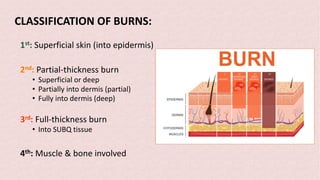 CLASSIFICATION OF BURNS:
1st: Superficial skin (into epidermis)
2nd: Partial-thickness burn
• Superficial or deep
• Partially into dermis (partial)
• Fully into dermis (deep)
3rd: Full-thickness burn
• Into SUBQ tissue
4th: Muscle & bone involved
 