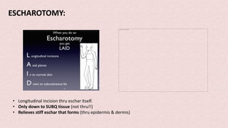 ESCHAROTOMY:
The picture can't be displayed.
• Longitudinal incision thru eschar itself.
• Only down to SUBQ tissue (not thru!!)
• Relieves stiff eschar that forms (thru epidermis & dermis)
 