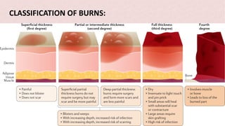 CLASSIFICATION OF BURNS:
 