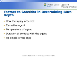 Burns.ppt