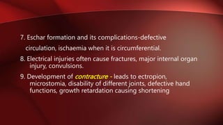 burns management and burns etiology of burns | PPTX