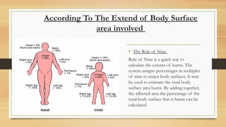 According To The Extend of Body Surface
area involved
• The Rule of Nine
Rule of Nine is a quick way to
calculate the extents of burns. The
system assigns percentages in multiples
of nine to major body surfaces. It may
be used to estimate the total body
surface area burnt. By adding together,
the affected area the percentage of the
total body surface that is burnt can be
calculated
 