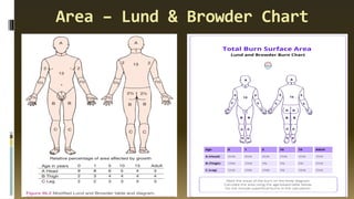 Area – Lund & Browder Chart
 
