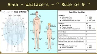 Area – Wallace’s – “ Rule of 9 ”
 