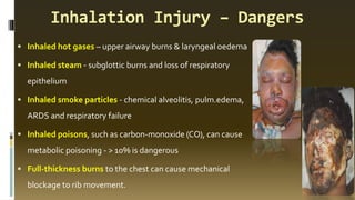 Inhalation Injury – Dangers
▪ Inhaled hot gases – upper airway burns & laryngeal oedema
▪ Inhaled steam - subglottic burns and loss of respiratory
epithelium
▪ Inhaled smoke particles - chemical alveolitis, pulm.edema,
ARDS and respiratory failure
▪ Inhaled poisons, such as carbon-monoxide (CO), can cause
metabolic poisoning - > 10% is dangerous
▪ Full-thickness burns to the chest can cause mechanical
blockage to rib movement.
 