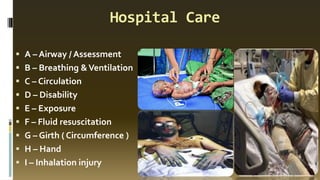 Hospital Care
▪ A – Airway / Assessment
▪ B – Breathing &Ventilation
▪ C – Circulation
▪ D – Disability
▪ E – Exposure
▪ F – Fluid resuscitation
▪ G – Girth ( Circumference )
▪ H – Hand
▪ I – Inhalation injury
 