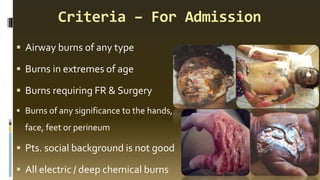 Criteria – For Admission
▪ Airway burns of any type
▪ Burns in extremes of age
▪ Burns requiring FR & Surgery
▪ Burns of any significance to the hands,
face, feet or perineum
▪ Pts. social background is not good
▪ All electric / deep chemical burns
 