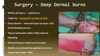 Surgery – Deep Dermal burns
▪ Within 48 hours - < 25% burns.
▪ Called as –Tangential excision & SSG
▪ Dead dermis - removed layer by layer until
fresh bleeding occurs.
▪ Topical adrenaline (DILUTED) reduces
bleeding.
▪ All burnt tissue needs to be excised.
▪ Stable cover should be applied at once to
reduce burn load – SSG.
 