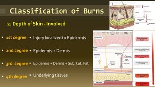 Classification of Burns
2. Depth of Skin - Involved
▪ 1st degree
▪ 2nd degree
▪ 3rd degree
▪ 4th degree
▪ Injury localized to Epidermis
▪ Epidermis + Dermis
▪ Epidermis + Dermis + Sub. Cut. Fat
▪ Underlying tissues
 