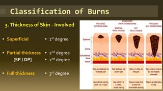 Classification of Burns
3.Thickness of Skin - Involved
▪ Superficial
▪ Partial thickness
[SP / DP]
▪ Full thickness
▪ 1st degree
▪ 2nd degree
▪ 2nd degree
▪ 3rd degree
 