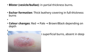 Burns.pptx helpful for Medial students to study | PPTX