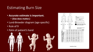 Estimating Burn Size
• Accurate estimate is important.
• (Size does matter.)
• Lund-Browder diagram (age-specific)
• Rule of 9
• Palm of patient’s hand
 
