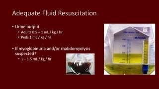Adequate Fluid Resuscitation
• Urine output
• Adults 0.5 – 1 mL / kg / hr
• Peds 1 mL / kg / hr
• If myoglobinuria and/or rhabdomyolysis
suspected?
• 1 – 1.5 mL / kg / hr
 