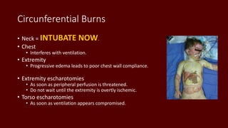 Circunferential Burns
• Neck = INTUBATE NOW.
• Chest
• Interferes with ventilation.
• Extremity
• Progressive edema leads to poor chest wall compliance.
• Extremity escharotomies
• As soon as peripheral perfusion is threatened.
• Do not wait until the extremity is overtly ischemic.
• Torso escharotomies
• As soon as ventilation appears compromised.
 