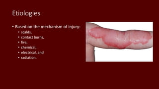 Etiologies
• Based on the mechanism of injury:
• scalds,
• contact burns,
• fire,
• chemical,
• electrical, and
• radiation.
 