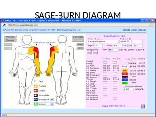 SAGE-BURN DIAGRAM
 
