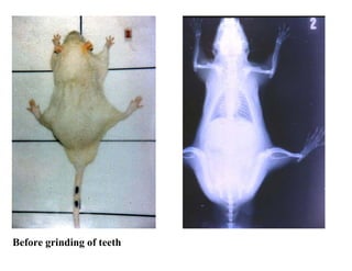 Before grinding of teeth
 