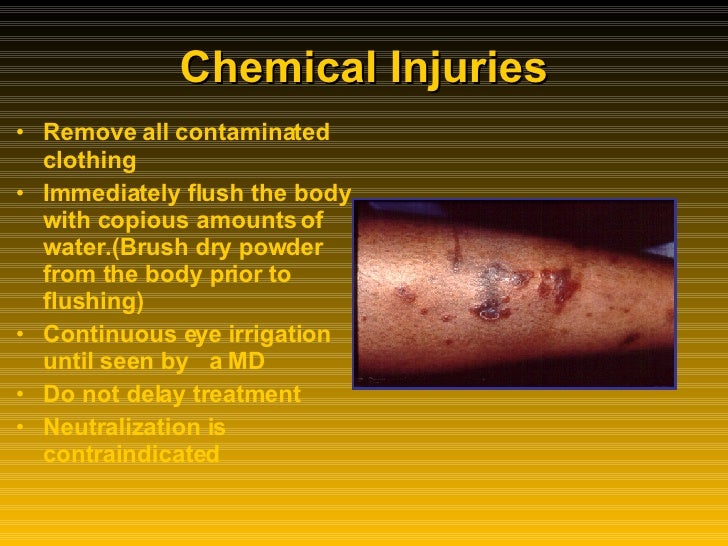 Burns (Thermal,Electrical,Lightening and Chemical Injuries)