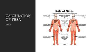 Tbsa Graph BURNS classification and management short presentation | PPTX