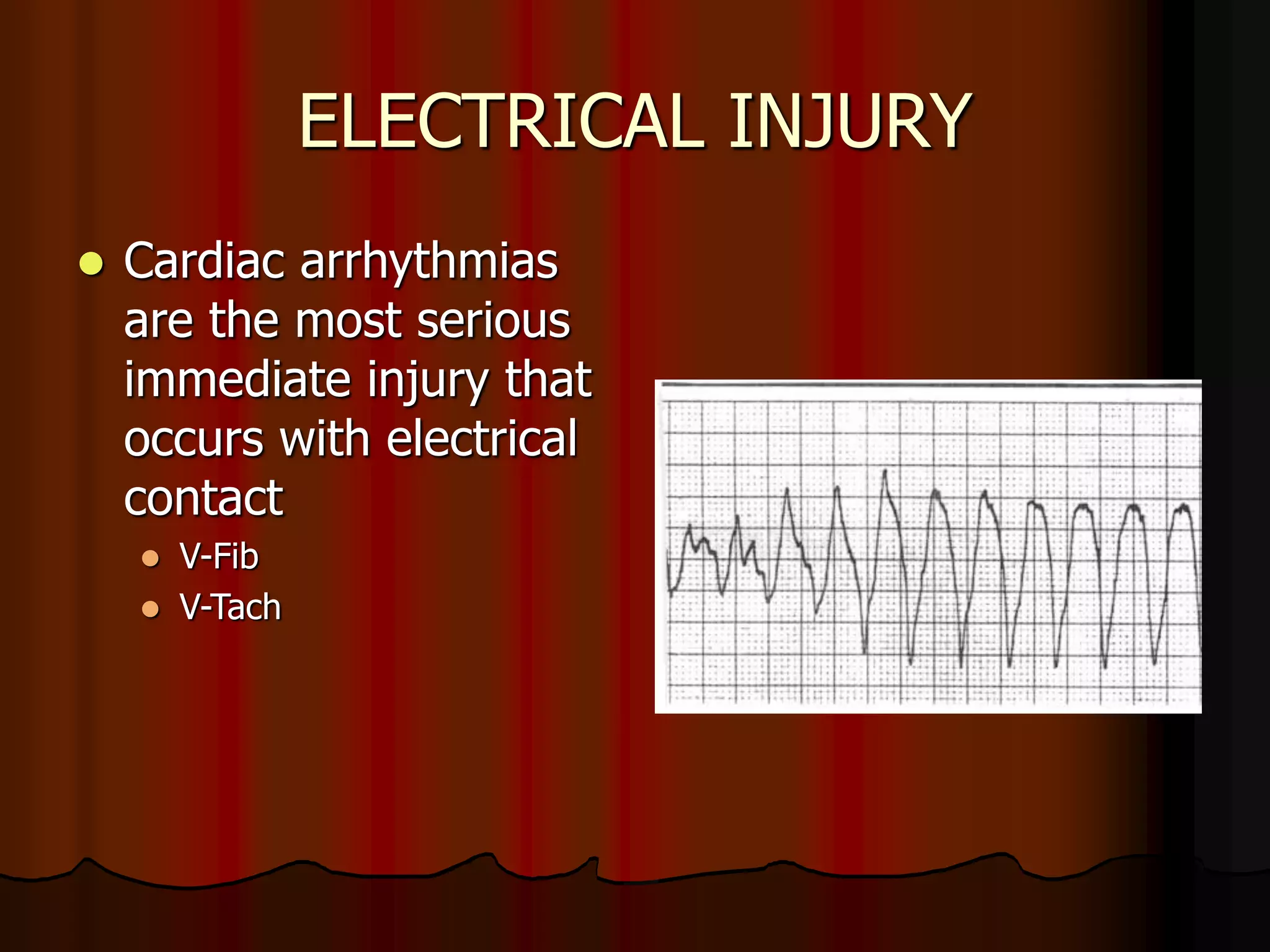 ELECTRICAL INJURY
 Cardiac arrhythmias
are the most serious
immediate injury that
occurs with electrical
contact
 V-Fib
 V-Tach
 