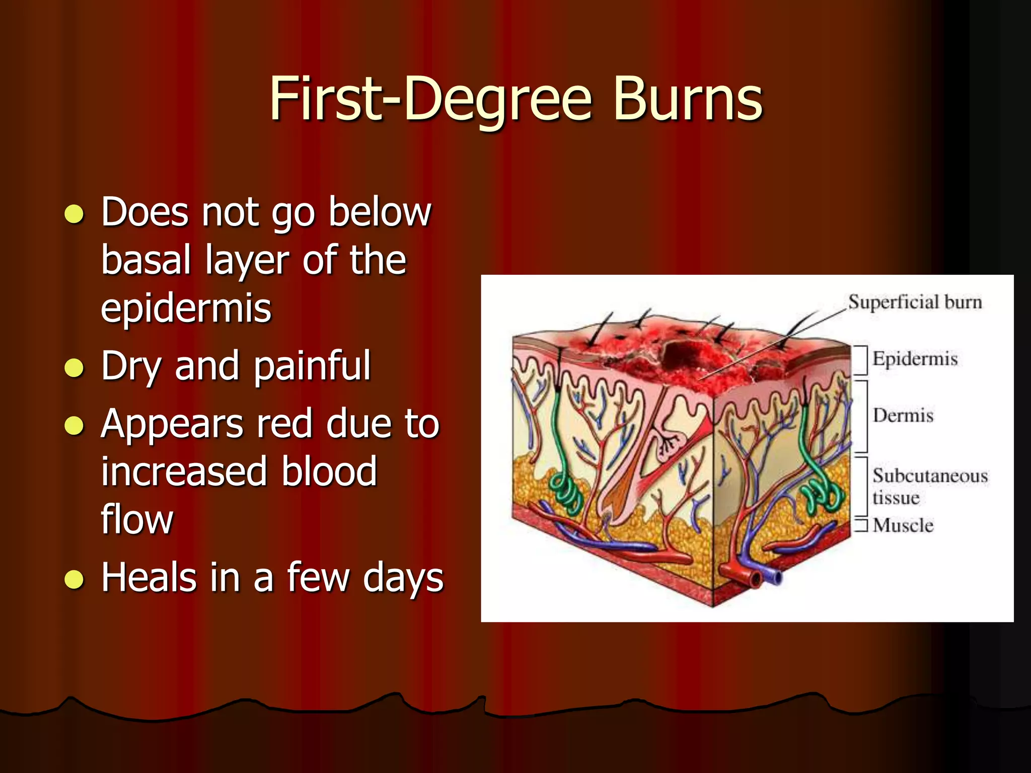 First-Degree Burns
 Does not go below
basal layer of the
epidermis
 Dry and painful
 Appears red due to
increased blood
flow
 Heals in a few days
 