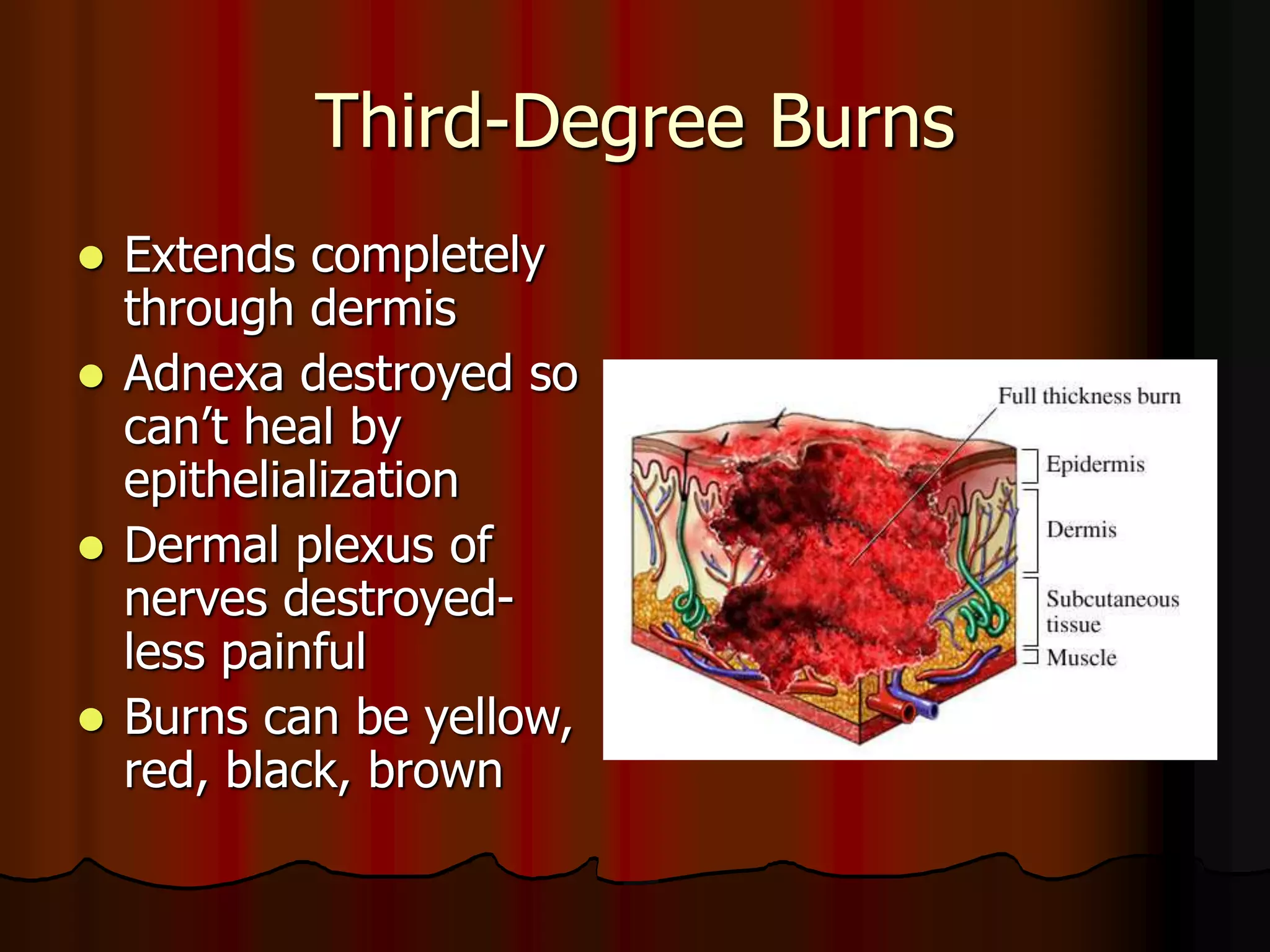 Third-Degree Burns
 Extends completely
through dermis
 Adnexa destroyed so
can’t heal by
epithelialization
 Dermal plexus of
nerves destroyed-
less painful
 Burns can be yellow,
red, black, brown
 