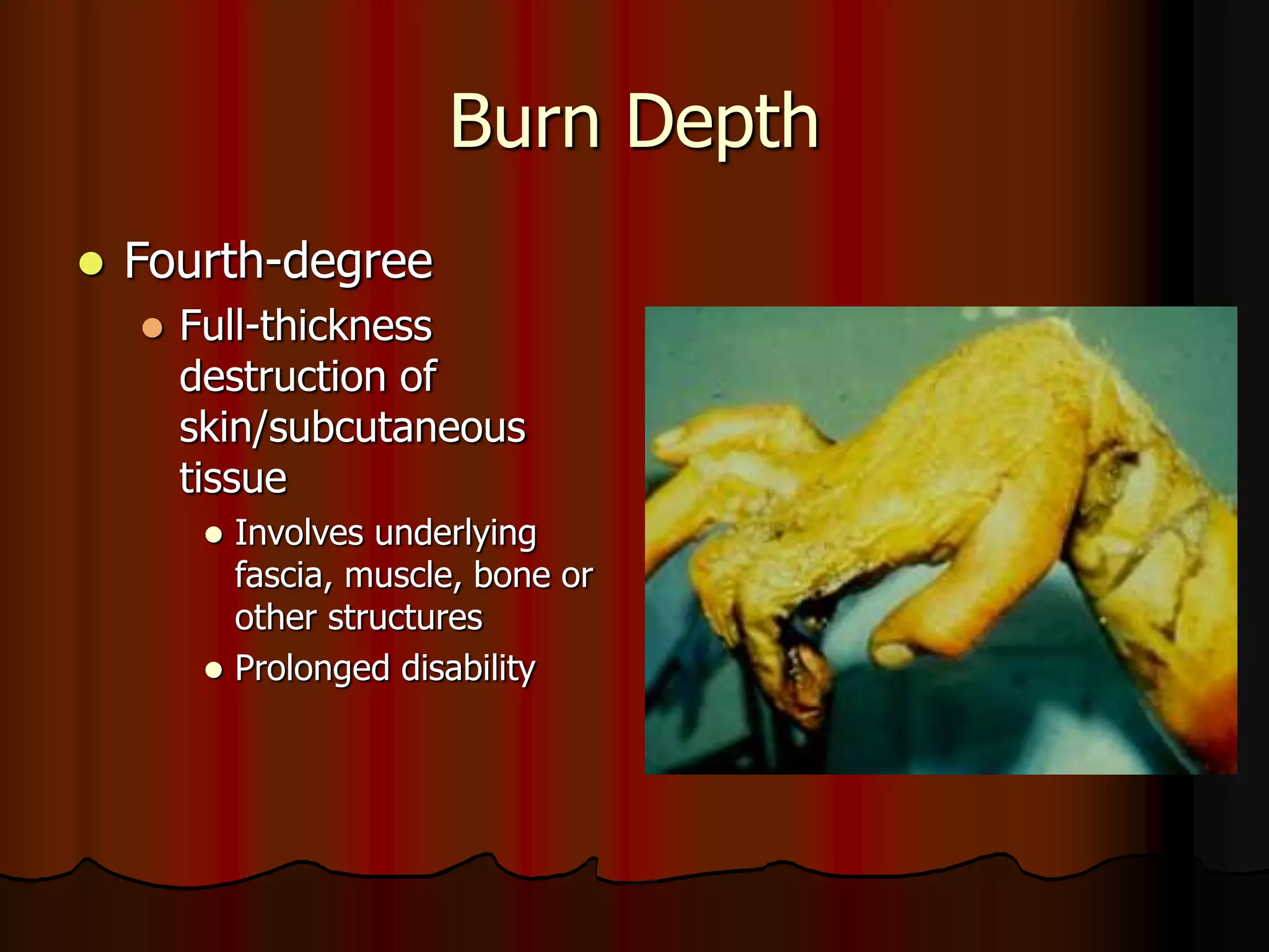 Burn Depth
 Fourth-degree
 Full-thickness
destruction of
skin/subcutaneous
tissue
 Involves underlying
fascia, muscle, bone or
other structures
 Prolonged disability
 